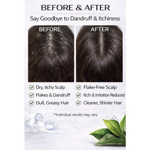 Neriah White Tea Anti-dandruff Shampoo 500ml